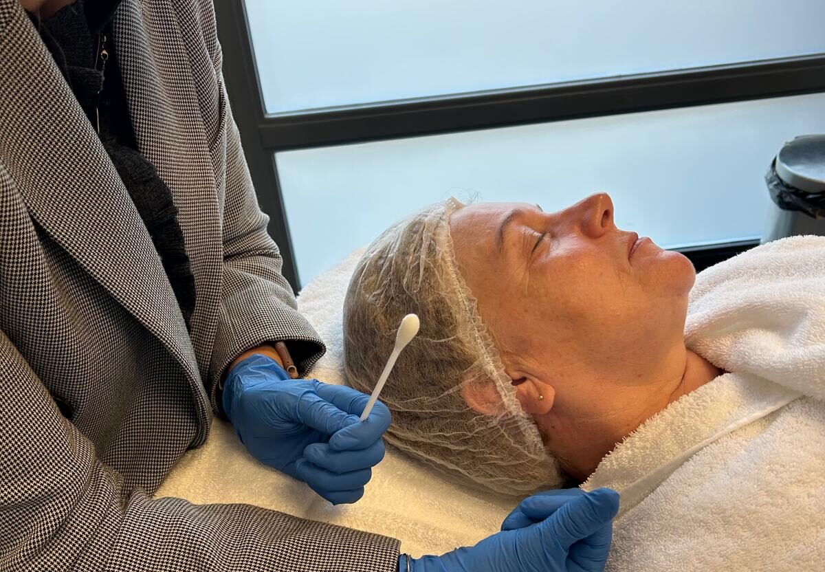 cosmo peel forte malden cosmo peel forte malden behandeling